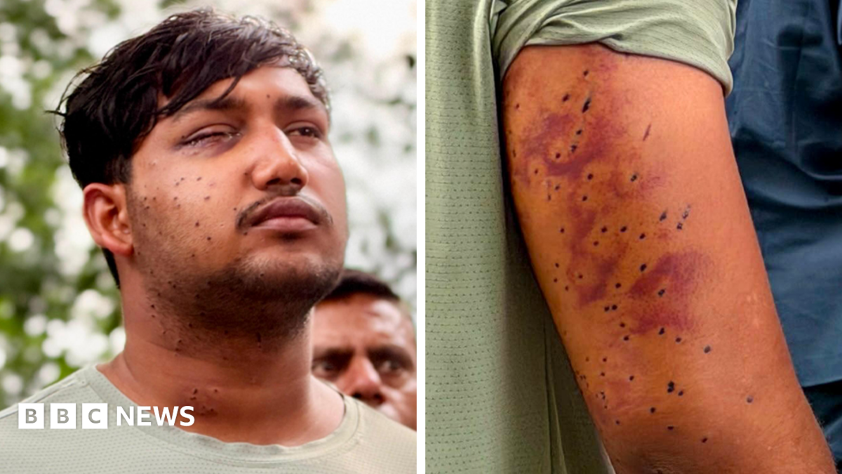 India’s ‘cockroach’ protesters have wounds consistent with pellet-gun fire, say experts