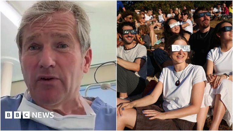 Did the eclipse damage your eyes?