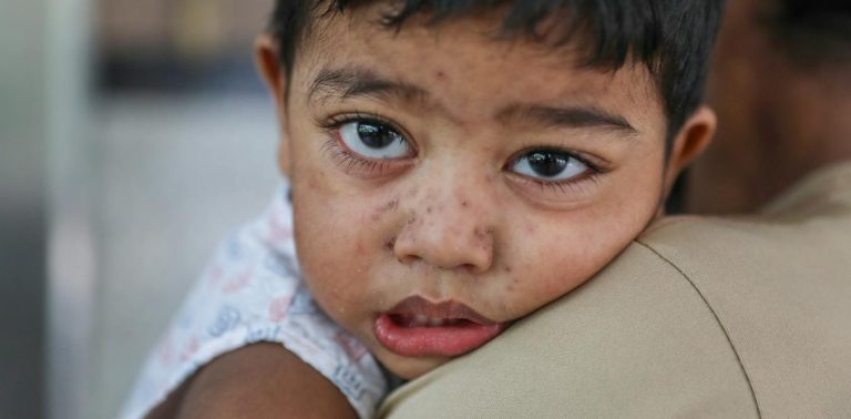 Bangladesh has lost 900 children to measles – a warning to other countries where vaccine rates have slipped