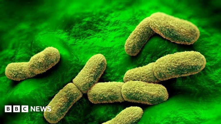 US ‘watching closely’ after plague researcher dies in Russia